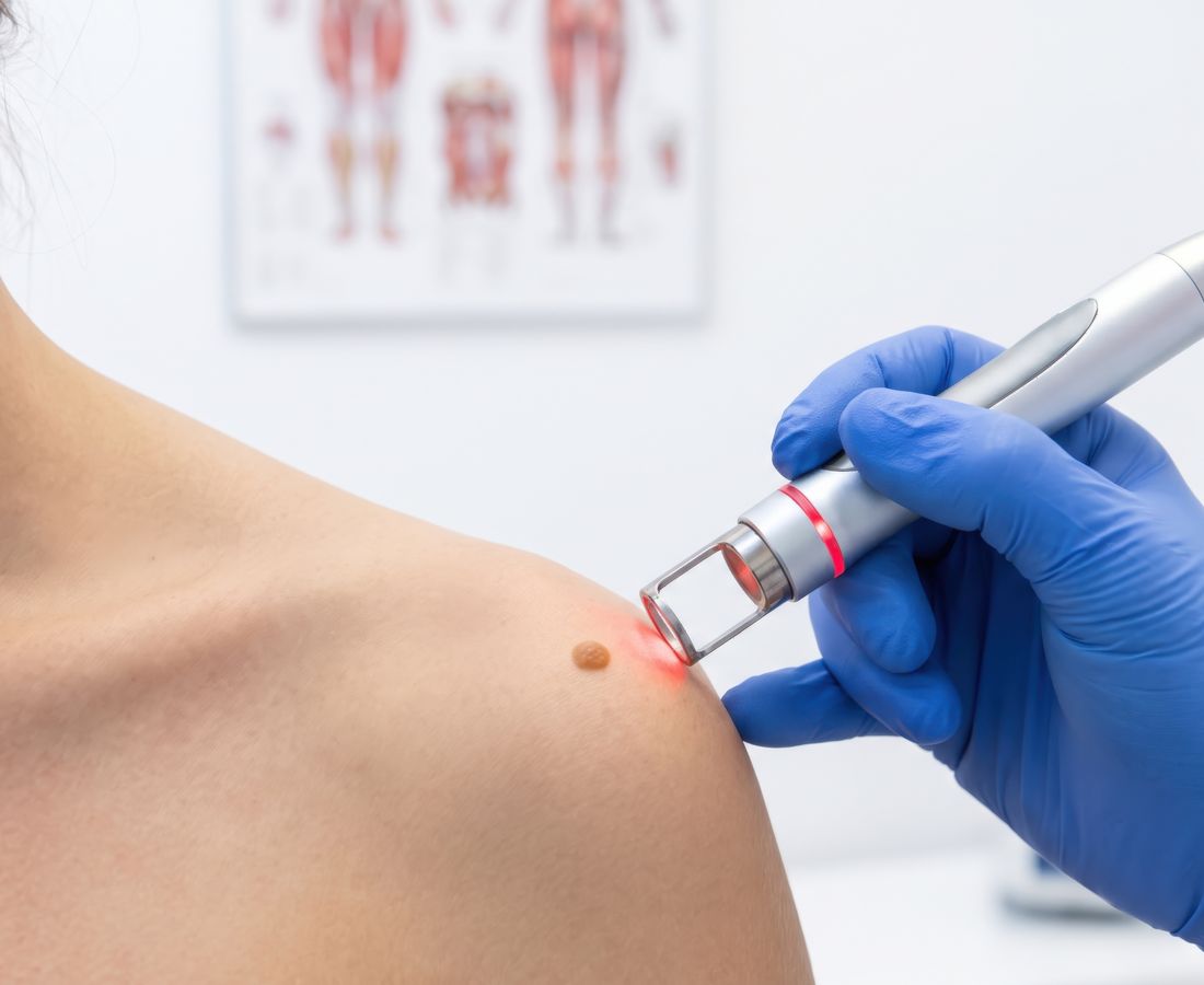 Clinician performing a precise treatment on a patient's back — representing BurnStrike's clinical precision and care